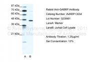 AVARP13034_T100 - GABRP