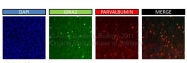 AVARP13038_T100 - Glutamate receptor 2 / GLUR2