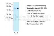 AVARP13041_T100 - Serotonin receptor 1A (HTR1A)
