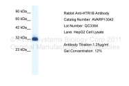 AVARP13042_T100 - Serotonin receptor 1B (HTR1B)