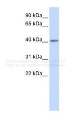 AVARP13047_P050 - Serotonin receptor 5A (HTR5A)
