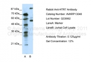 AVARP13048_P050 - Serotonin receptor 7 (HTR7)