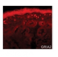 AVARP13060_T100 - Glutamate receptor 2 / GLUR2