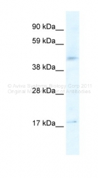 AVARP13073_T100 - Serotonin receptor 1F (HTR1F)
