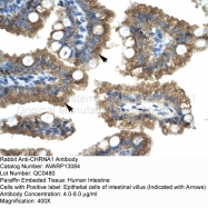 AVARP13084_P050 - Acetylcholine receptor alpha subunit