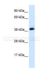 AVARP13084_P050 - Acetylcholine receptor alpha subunit