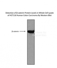 AVARP14001_T100 - Catenin beta-1