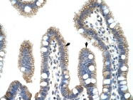 AVARP14001_T100 - Catenin beta-1
