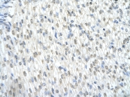 AVARP14001_T100 - Catenin beta-1
