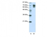 AVARP14001_T100 - Catenin beta-1