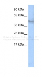 AVARP15002_T100 - Cytokeratin 14