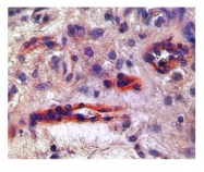AVARP20010_P050 - CD309 / VEGFR-2 / Flk-1