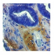 AVARP20016_T100 - MMP-2