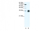 P100779_T100 - RELA / NF-kB p65