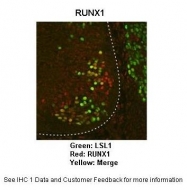 P100814_P050 - RUNX1