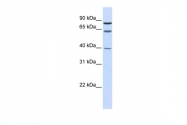 P100873_P050 - Estrogen receptor alpha