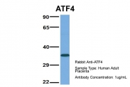 P100913_P050 - ATF4