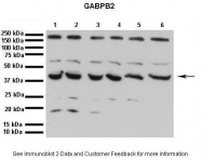 P100925_P050 - GABPB1
