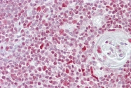 P100975_P050 - NFAT4 / NFATC3