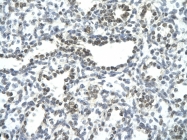 P100975_P050 - NFAT4 / NFATC3