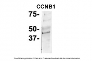 ARP30161_P050 - Cyclin B1