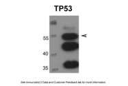 ARP30311_P050 - TP53 / p53