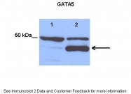 ARP31627_P050 - GATA5