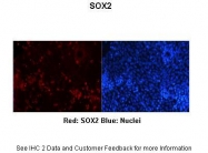 ARP31737_P050 - SOX2