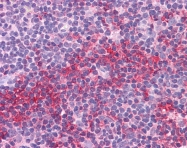ARP31737_P050 - SOX2