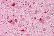 ARP32208_P050 - GS homeobox 2 / GSH2