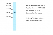 ARP32256_P050 - NR2F6