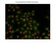 ARP32422_P050 - ZEB1