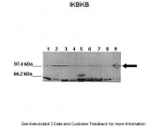 ARP32665_P050 - IKBKB / IKKB