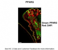 ARP32880_T100 - PPAR-gamma