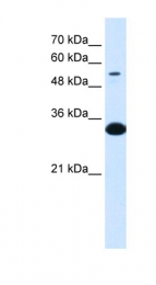 ARP33810_T100 - Alpha-1B-glycoprotein / A1BG