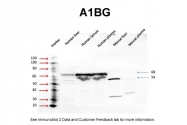 ARP33810_T100 - Alpha-1B-glycoprotein / A1BG