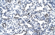 ARP34094_T100 - Nucleophosmin