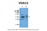 ARP35123_P050 - VDAC2