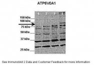 ARP37232_P050 - ATP6V0A1
