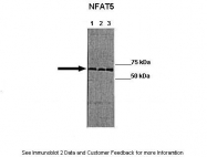 ARP37465_P050 - NFAT5
