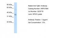 ARP37894_P050 - TGFB1