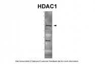 ARP38530_T100 - HDAC1