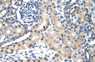 ARP38933_P050 - STAT1