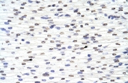 ARP40204_T100 - ANP32A