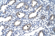 ARP40205_T100 - Cytokeratin 18