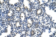 ARP40568_T100 - PCBP2 / hnRNP-E2