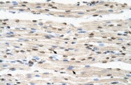 ARP40585_T100 - hnRPD-like protein / HNRPDL
