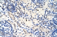 ARP40646_P050 - RNASEH2A