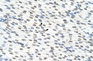 ARP40889_P050 - RBM22