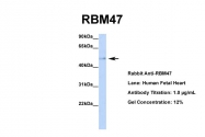 ARP40932_P050 - RBM47
